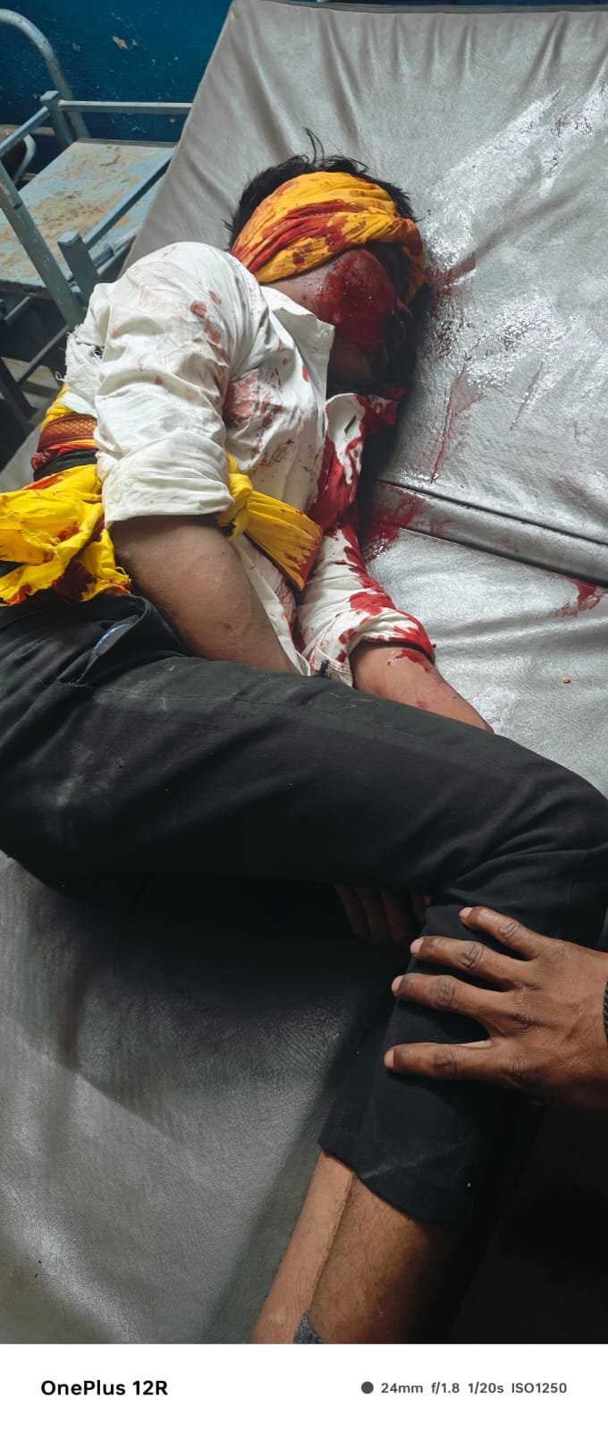 बाइक साईकिल की टक्कर मे दोनों की हालत गम्भीर